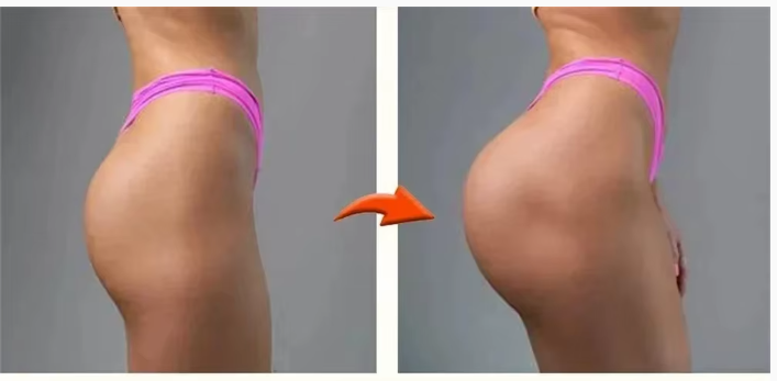 Creme para aumento de glúteos, óleo essencial firmador e lifting de bumbum, melhora o crescimento do quadril e Bumbum, firma  Empina e modela